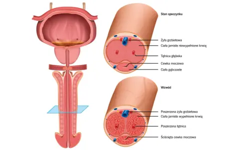 Anatomia penisa: przekroje w stanie spoczynku i wzwodu pokazują, że czy penis to mięsień, jest złożoną strukturą z ciałami jamistymi i cewką moczową.