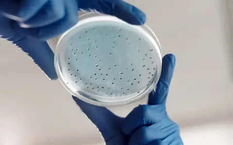 Badanie laboratoryjne wykazuje obecność drobnoustrojów, które mogą być przyczyną infekcji intymnej po antybiotyku.